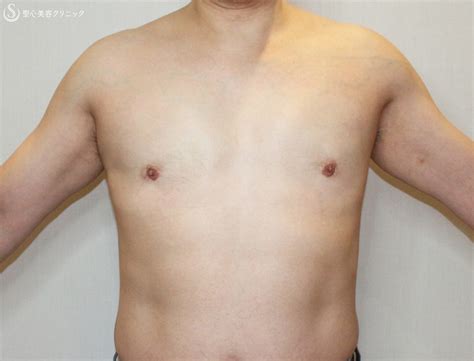 男 乳 輪 でかい|男なのですが、乳輪の直径が3.5cmほどあります。これは大きい .